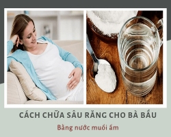 Cách chữa đau răng cho bà bầu bằng thảo dược tốt nhất