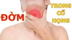 Đờm là gì? Hiểu đúng về đờm để xử lý hiệu quả và an toàn