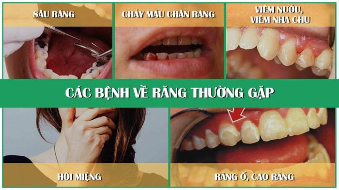 Cach phong ngua chua tri benh rang mieng cho tre nho